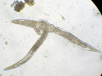 Image: Strongyloides stercoralis (Photo courtesy of the Swiss Tropical and Public Health Institute).